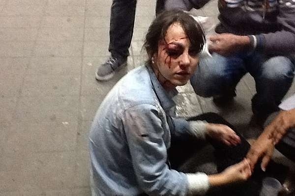 A jornalista Giuliana Vallone atingida no olho por uma bala de borracha enquanto cobria a manifestação
