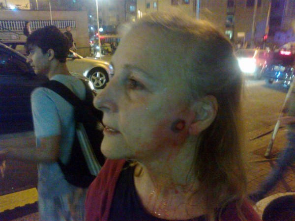 Mulher é atingida durante confronto com a PM e manifestantes