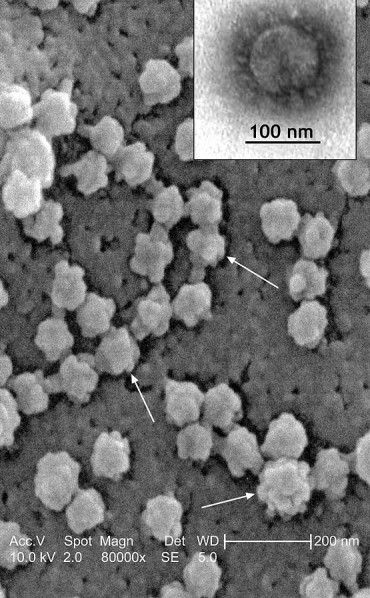 Vírus da Síndrome Respiratória Aguda Grave, SARS, aumentado em microscópio eletrônico